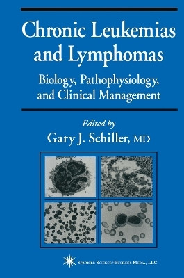 Chronic Leukemias and Lymphomas(English, Paperback, unknown)