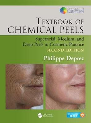 Textbook of Chemical Peels(English, Electronic book text, Deprez Philippe)