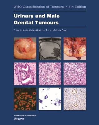 WHO classification of tumours of the urinary system and male genital organs(English, Paperback, International Agency for Research on Cancer)
