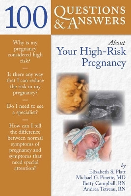 100 Questions & Answers About Your High-Risk Pregnancy(English, Paperback, Platt Elizabeth S.)