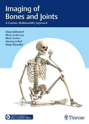 Imaging of Bones and Joints(English, Hardcover, unknown)