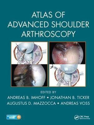 Atlas of Advanced Shoulder Arthroscopy(English, Hardcover, unknown)