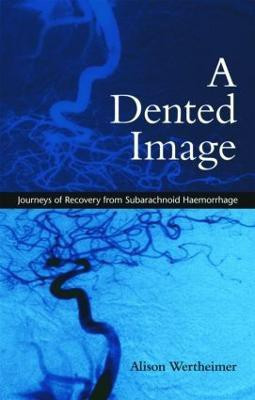A Dented Image(English, Paperback, Wertheimer Alison)