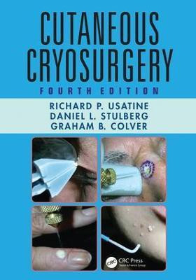 Cutaneous Cryosurgery(English, Electronic book text, Usatine Richard P.)