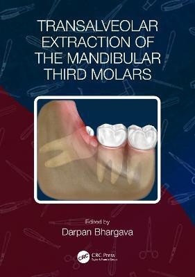 Transalveolar Extraction of the Mandibular Third Molars(English, Paperback, unknown)