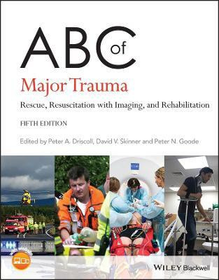 ABC of Major Trauma(English, Paperback, unknown)