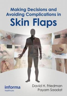 Making Decisions and Avoiding Complications in Skin Flaps(English, Hardcover, unknown)