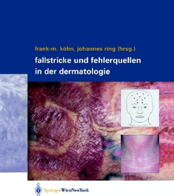 Fallstricke und Fehlerquellen in der Dermatologie(German, Paperback, unknown)
