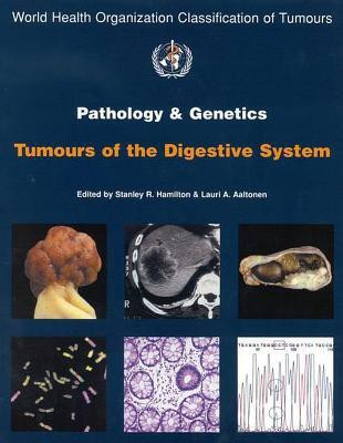 Pathology and Genetics of Tumours of the Digestive System(English, Paperback, unknown)