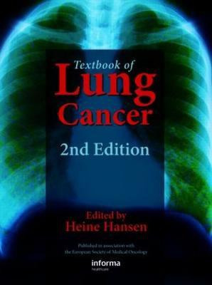 Textbook of Lung Cancer 2 2nd  Edition(English, Hardcover, unknown)