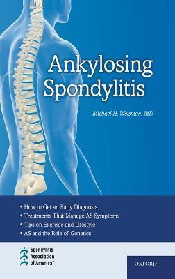 Ankylosing Spondylitis(English, Hardcover, Weisman Michael H.)