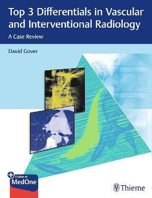 Top 3 Differentials in Vascular and Interventional Radiology(English, Mixed media product, Gover David D.)