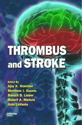 Thrombus and Stroke(English, Hardcover, unknown)