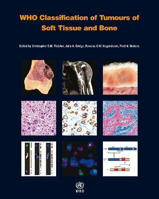 WHO Classification of Tumours of Soft Tissue and Bone(English, Paperback, unknown)