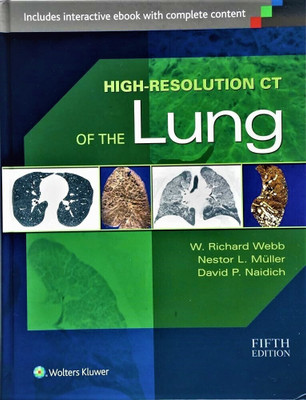 HIGH RESOLUTION CT OF THE LUNG 5ED VOLUME 1&2  - HIGH RESOLUTION CT OF THE LUNG BY WEBB(Paperback, WEBB W.R.)