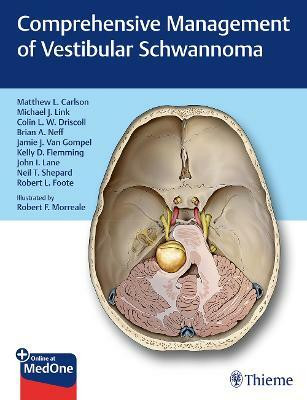 Comprehensive Management of Vestibular Schwannoma(English, Mixed media product, unknown)