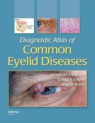 Diagnostic Atlas of Common Eyelid Diseases(English, Electronic book text, Dutton Jonathan J.)