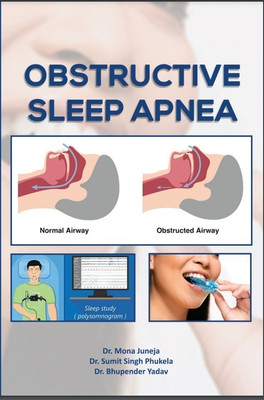 Obstructive Sleep Apnea(Paperback, Dr. Mona Juneja,Dr. Sumit Singh Phukela,Dr. Bhupender Yadav)