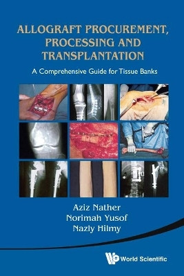 Allograft Procurement, Processing And Transplantation: A Comprehensive Guide For Tissue Banks(English, Hardcover, unknown)