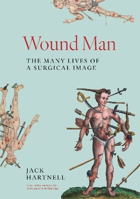 Wound Man(English, Hardcover, Hartnell Jack)