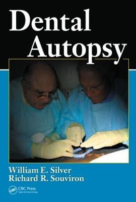 Dental Autopsy(English, Hardcover, Silver William E.)