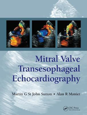 Mitral Valve Transesophageal Echocardiography(English, Paperback, St. John Sutton Martin G.)