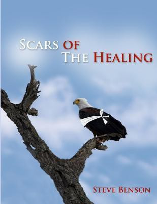 Scars of the Healing(English, Paperback, Benson Steve)