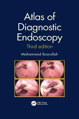 Atlas of Diagnostic Endoscopy, 3E(English, Paperback, Ibrarullah Mohammad)