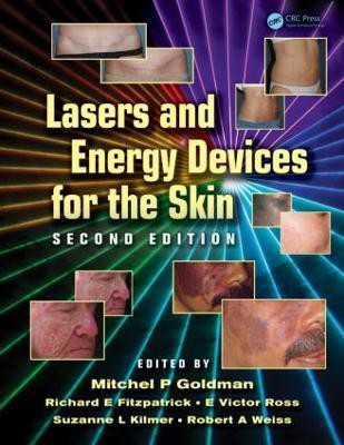 Lasers and Energy Devices for the Skin(English, Hardcover, unknown)