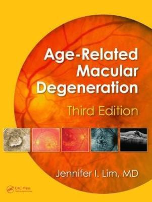 Age-Related Macular Degeneration(English, Hardcover, unknown)