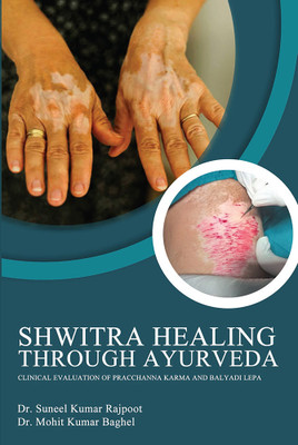 Shwitra Healing through Ayurveda: Clinical Evaluation of Pracchanna Karma and Balyadi Lepa(Paperback, Dr. Suneel Kumar Rajpoot ,Dr. Mohit Kumar Baghel)