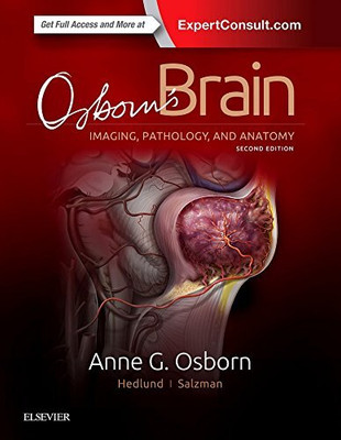 Osborn’s Brain, 2nd Edition With Complimentary 1000 Pages Medical Notebook(spiral+HARDCOVER, Osborn)