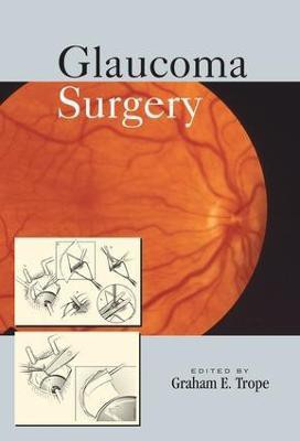 Glaucoma Surgery(English, Electronic book text, unknown)