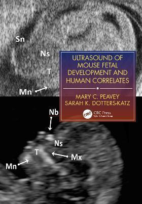 Ultrasound of Mouse Fetal Development and Human Correlates(English, Paperback, Peavey Mary C.)