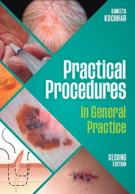 Practical Procedures in General Practice, second edition(English, Paperback, Kochhar Suneeta)