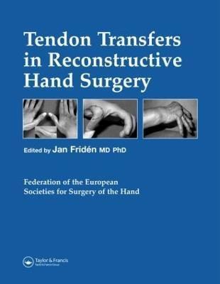 Tendon Transfers in Reconstructive Hand Surgery(English, Hardcover, Friden Jan)