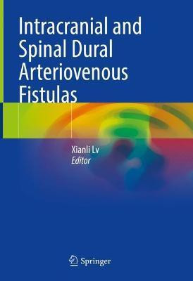 Intracranial and Spinal Dural Arteriovenous Fistulas(English, Hardcover, unknown)