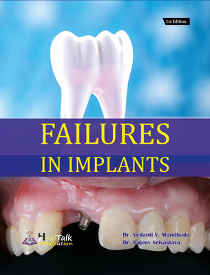 Failures In Implants  - Heal talk Publication(Paperback, Dr Rajeev Srivastava)