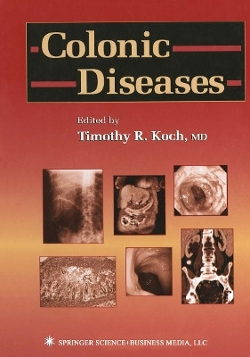 Colonic Diseases(English, Paperback, unknown)