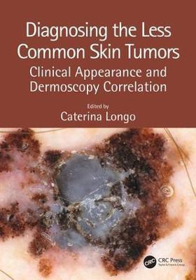 Diagnosing the Less Common Skin Tumors(English, Hardcover, unknown)