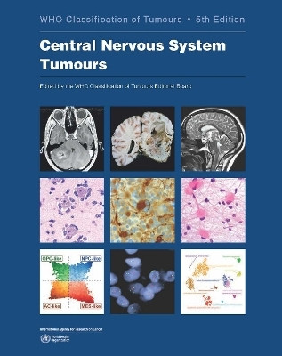 WHO classification of tumours of the central nervous system(English, Paperback, International Agency for Research on Cancer)