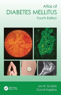 Atlas of Diabetes Mellitus(English, Paperback, Scobie Ian N.)