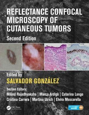 Reflectance Confocal Microscopy of Cutaneous Tumors(English, Hardcover, unknown)