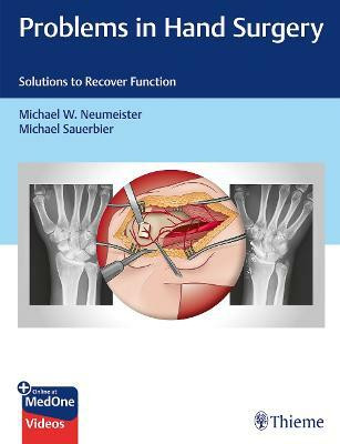 Problems in Hand Surgery(English, Hardcover, unknown)