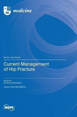 Current Management of Hip Fracture(English, Hardcover, unknown)