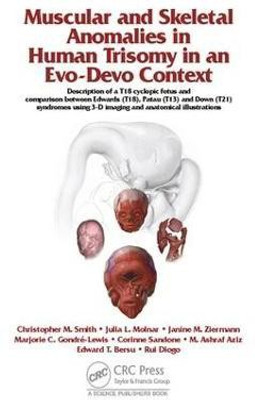 Muscular and Skeletal Anomalies in Human Trisomy in an Evo-Devo Context(English, Electronic book text, Diogo Rui)