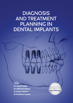 Diagnosis and Treatment Planning in Dental Implants with 1 Disc(Paperback, Dr. Avya Pandey, Dr. Abhilasha Bhasin, Dr Sneha S Mantri, Dr Anushree Saxena)