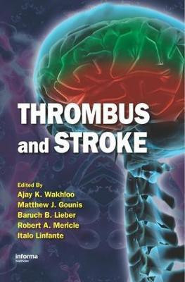Thrombus and Stroke(English, Electronic book text, unknown)