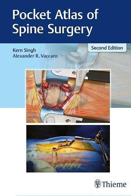Pocket Atlas of Spine Surgery(English, Paperback, Singh Kern)