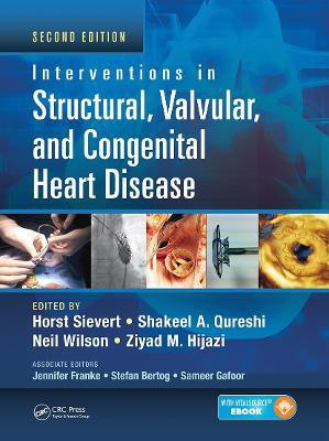 Interventions in Structural, Valvular and Congenital Heart Disease(English, Hardcover, unknown)